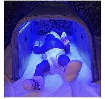 Фотолампа от желтушки в Ташкенте . Fotolampa sotiladi. Продам фотоламп