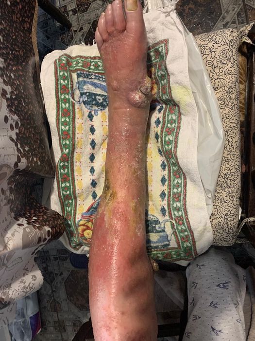 Хладилен Транспорт -20 /+20 Двутемперетурен/ Фактура