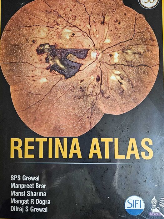 Carti Oftalmologie (Medicina) noi-noute