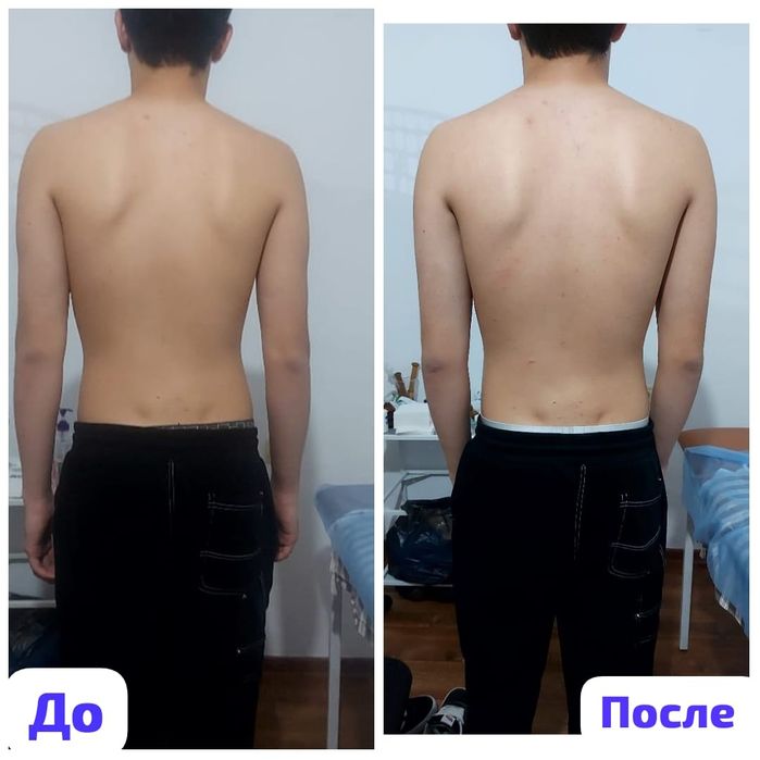 Мануальная терапия/массаж/иглотерапия