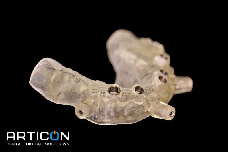 3Diagnosys 4.2+PlastyCad установка онлайн + обучающие видеоролики