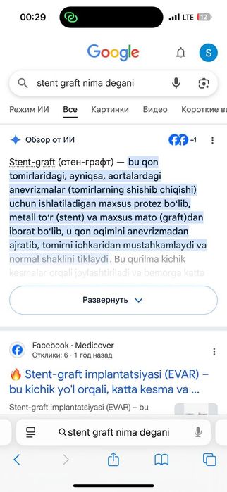 Srochna STENT-GRAFT 0.035  aorta tomirlariga yangi ochilmagan