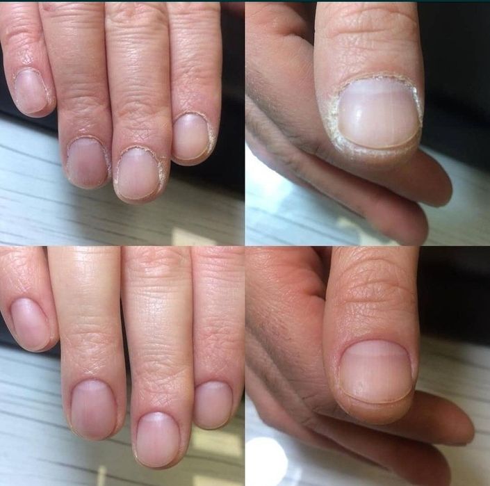 Мужской педикюр, маникюр.