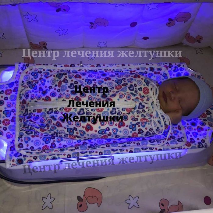 Фотолампа от желтухи