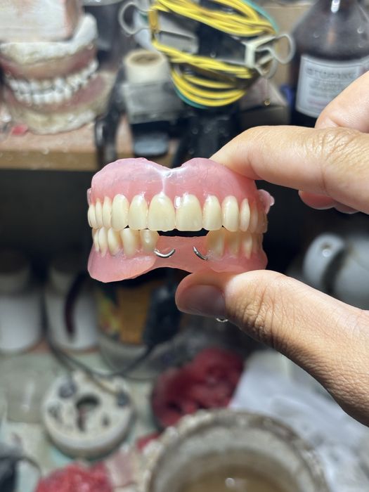 Изготовление сьемных протезов