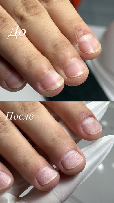 Обучение мастер маникюра "Под ключ"