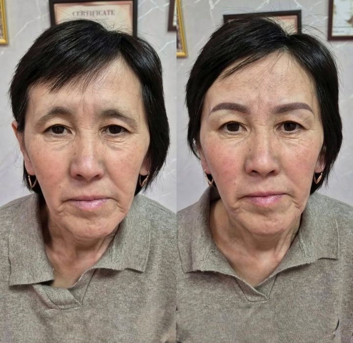 Действует только для женщин.