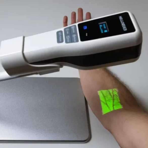 Venovizer – Vena topuvchi tibbiy qurilma | веновизор | Vein Finder