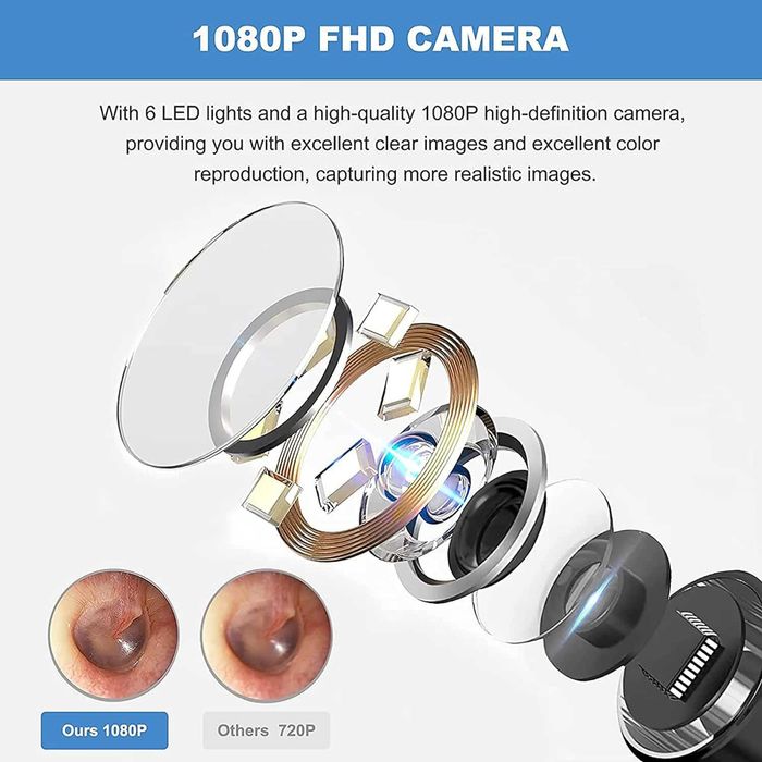 1080P FHD Otoscop Camera pentru urechi