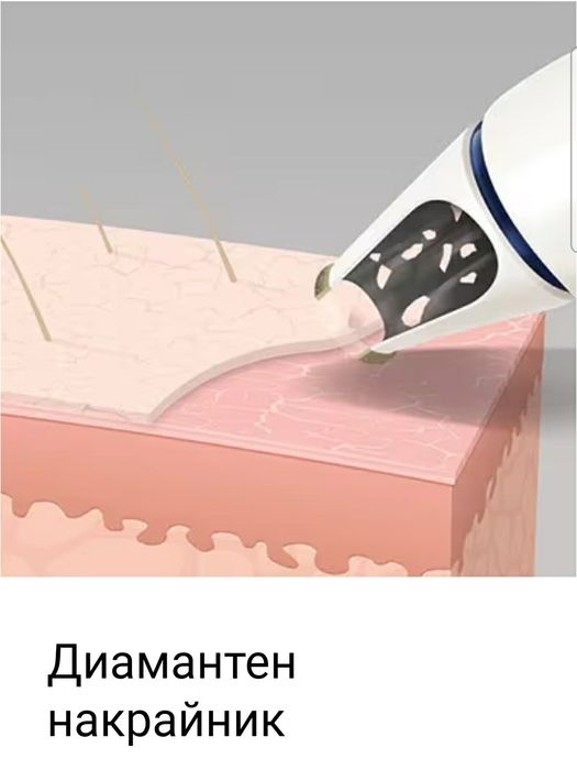 Уред за диамантено микродермабразио