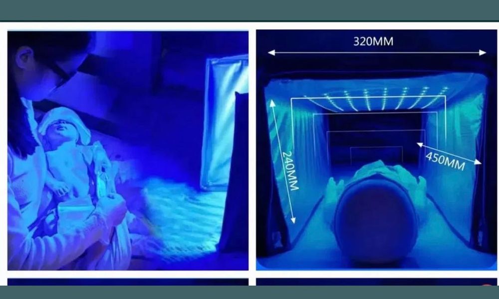 Лампы от желтухи