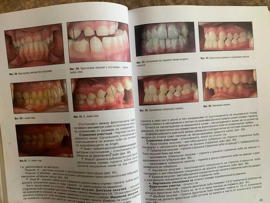 Ръководство по ортодонтия за студенти-проф.Вера Крумова