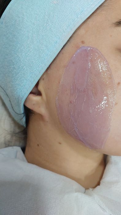 Депиляция полимерным воском