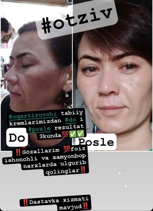 Tabiiy kremlar aksiyada