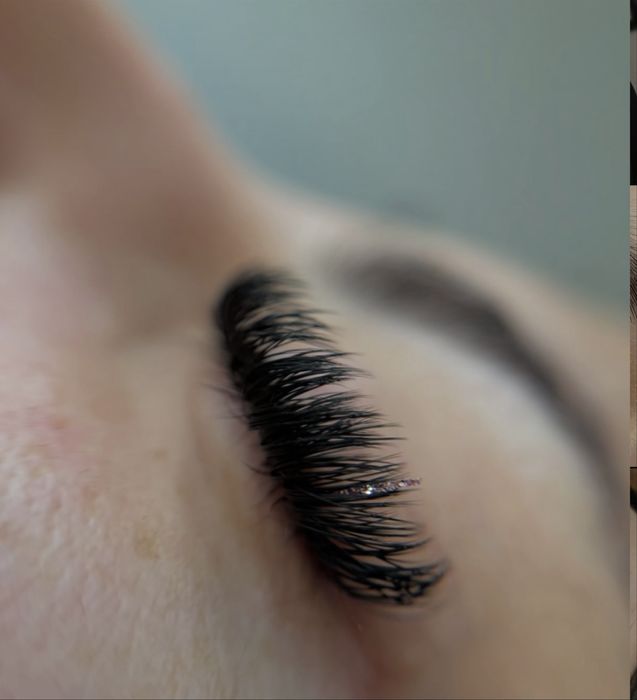 Gene de vis naturale