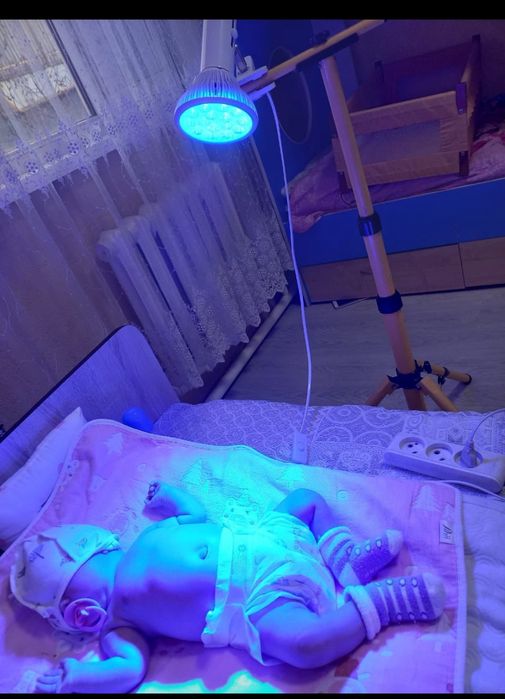 Фототерапия для новорожденных