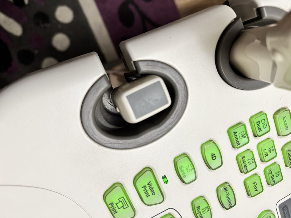 Узи аппарат SonoScape SSI 8000