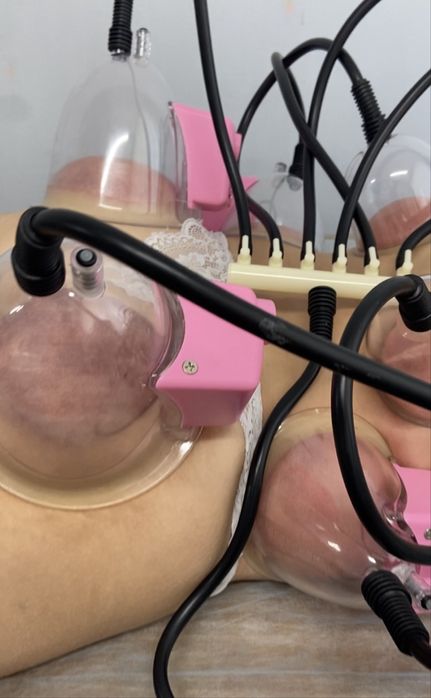 Аппарат для коррекции финуры