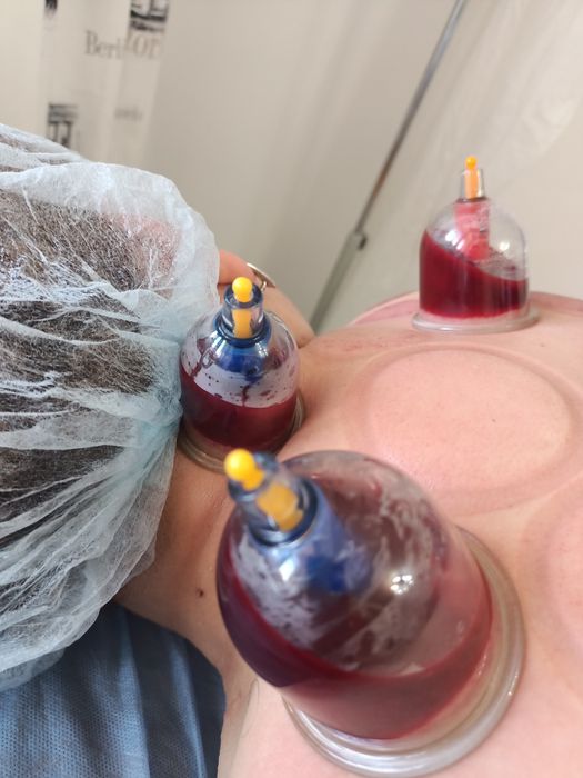 Народный метод лечения.