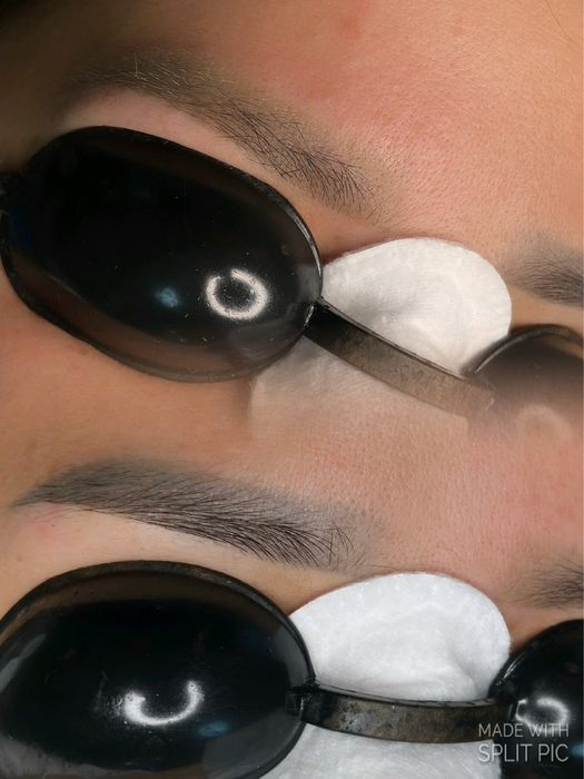 Удаления татуажа Костанай 5000т