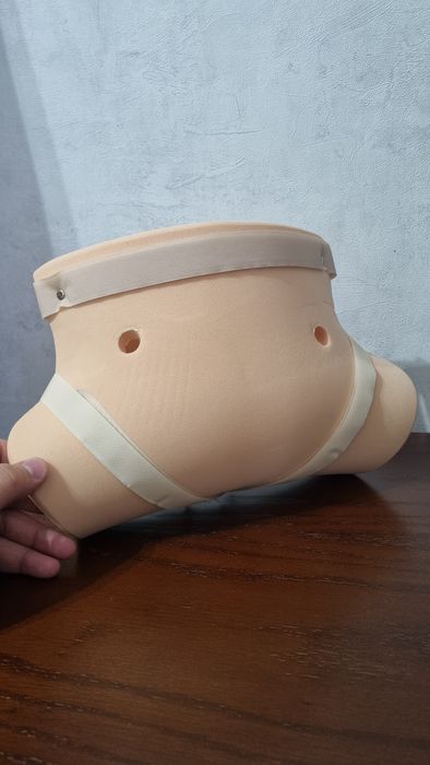 Мягкие шины при дисплазии