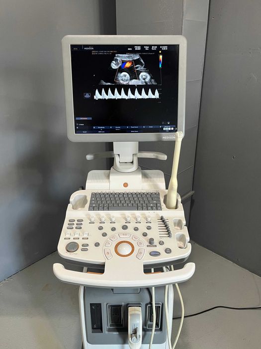 УЗИ аппарат Samsung R7