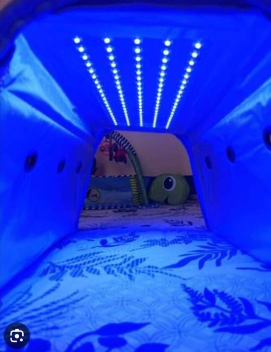 Фото лампа от желтушки