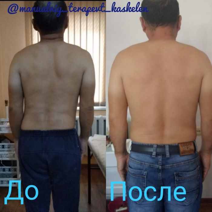 Хиджама/Массаж на выезд