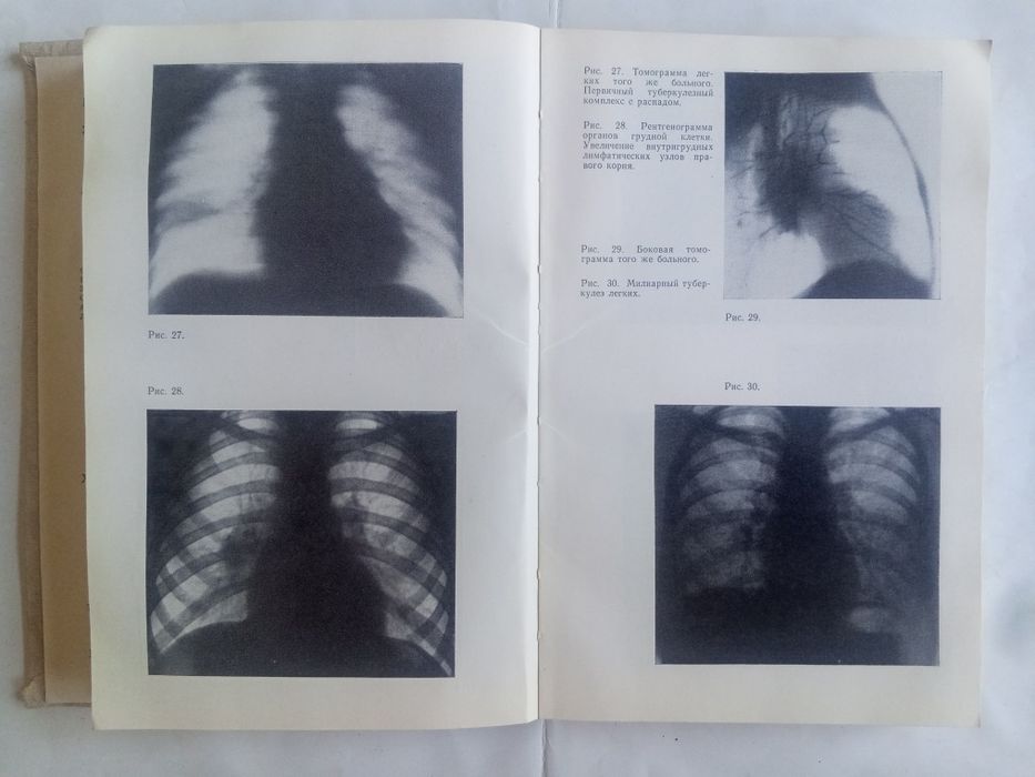 Китоб сотилади упка органи хакида