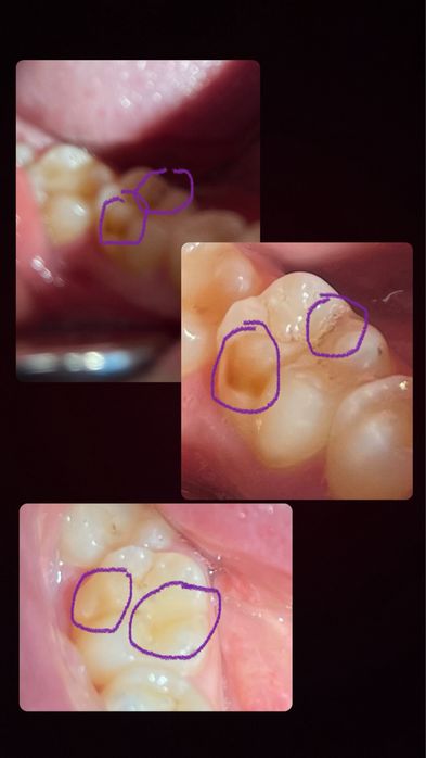 Евтини стоматологични услуги Пловдив