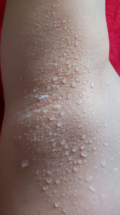 Акция для Девушек. Шугаринг со скидкой.