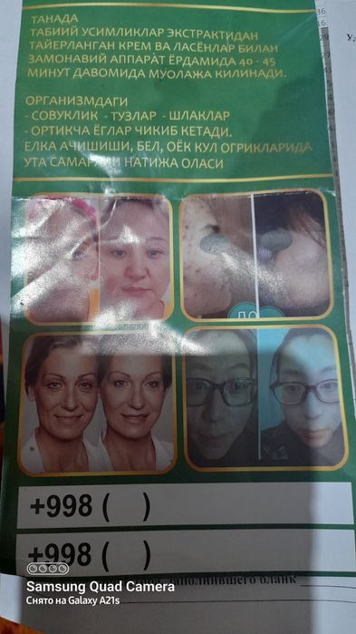 Ултра звуковой апарат для касметология