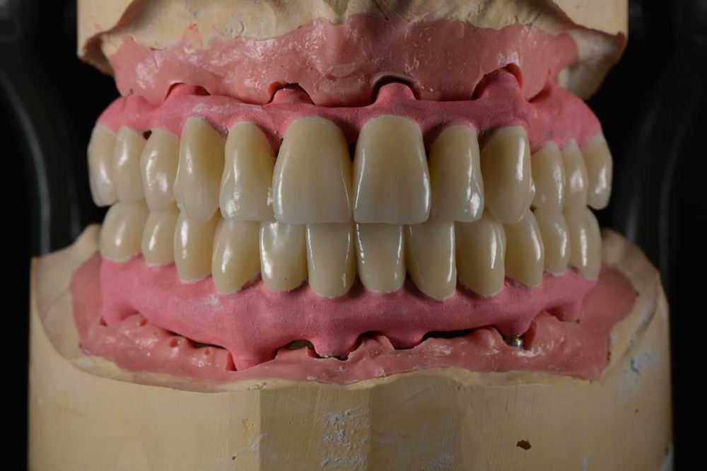 CAD/CAM в стоматологии зуботехнических лаборатория зубных протезов