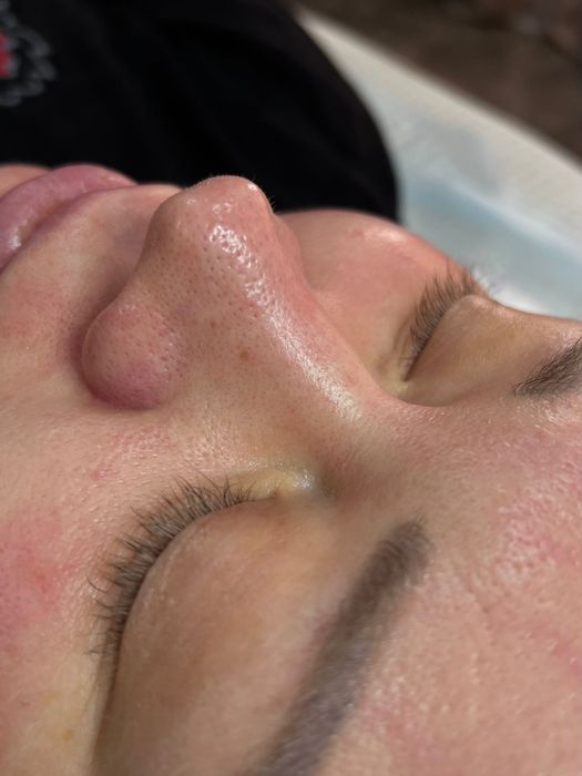 Косметологические процедуры