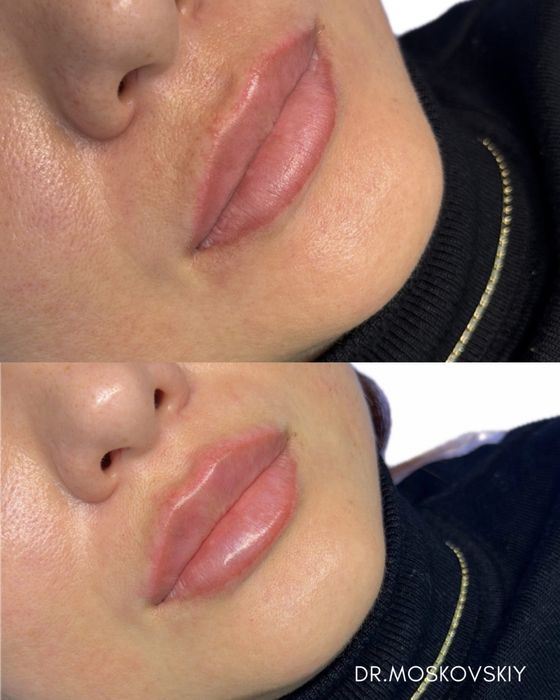 Косметолог | Алмата