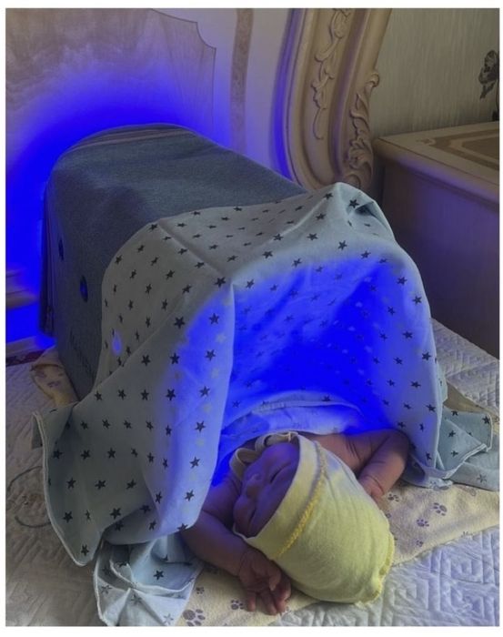 Лампа кювез от желтушки,эффект 100%