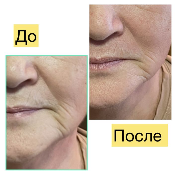 Внимание !!! Акция!!!