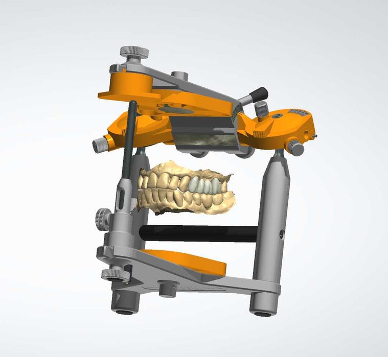 CAD/CAM дизайн |Корони, мостове, барове| 3Shape | Blender for Dental |
