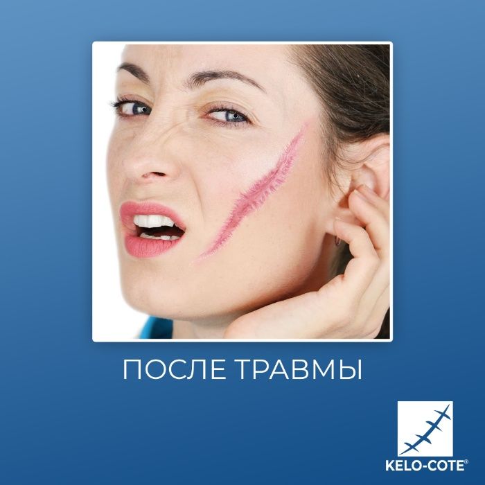 Kelo-Cote 10g-60g- силиконовый гель для рассасывания рубцов