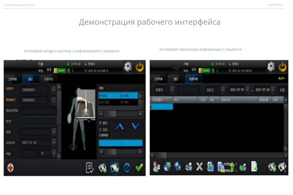 Портативный цифровой рентген аппарат. Mobile X-ray
