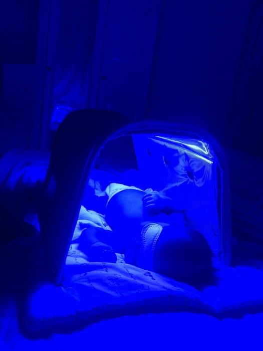 Фотолампа от желтушки