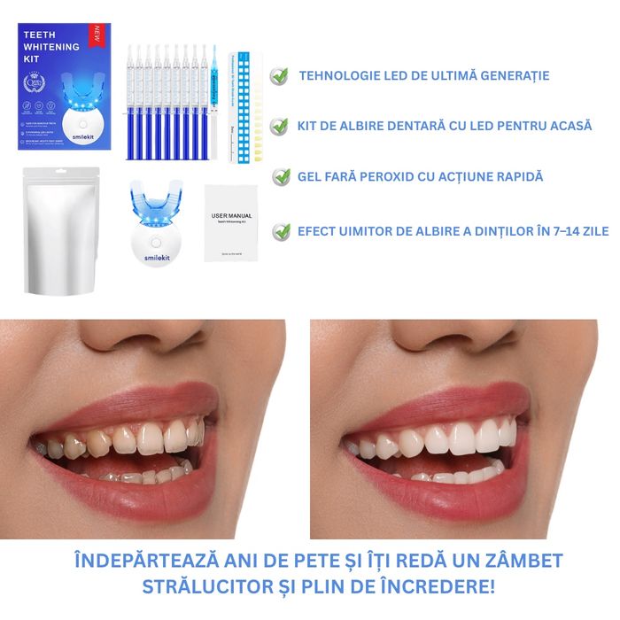 Kit de abire dinti - Set 10 seringi albire dentara