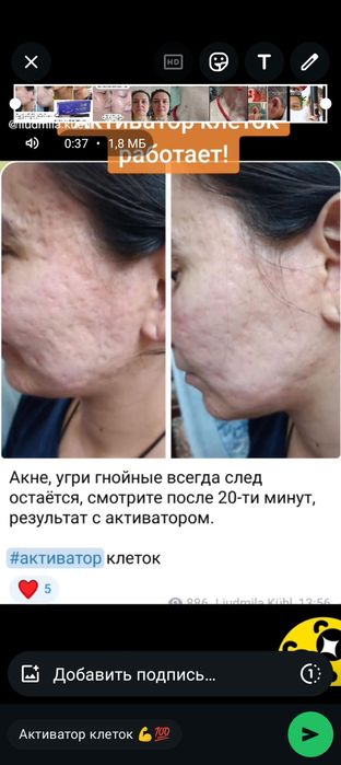 Продам аппарат Активатор клеток