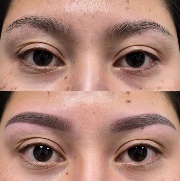 Действует только для женщин.