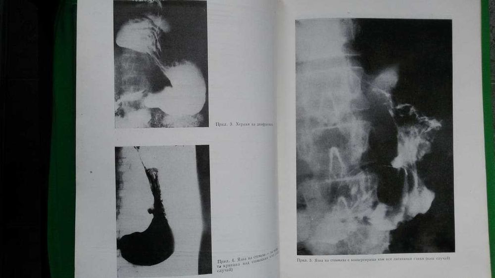 Ръководство по вътрешни болести  II том –акад.Ташев, проф.Пенчев и др.