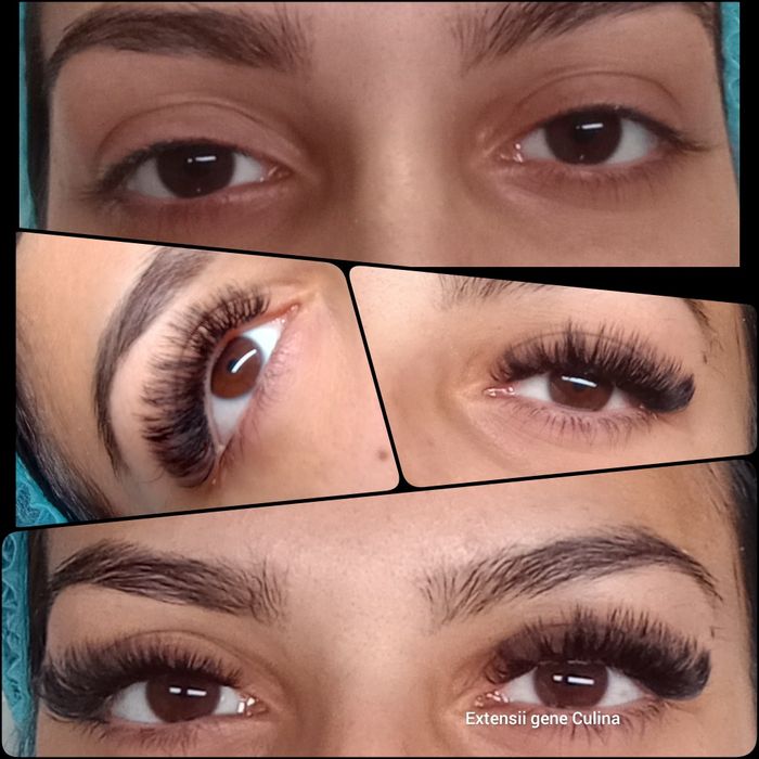 Extensii gene Galați