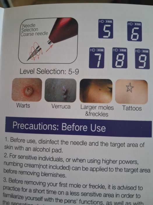 Лазер за премахване на бенки, татуировки и кокоши трън.