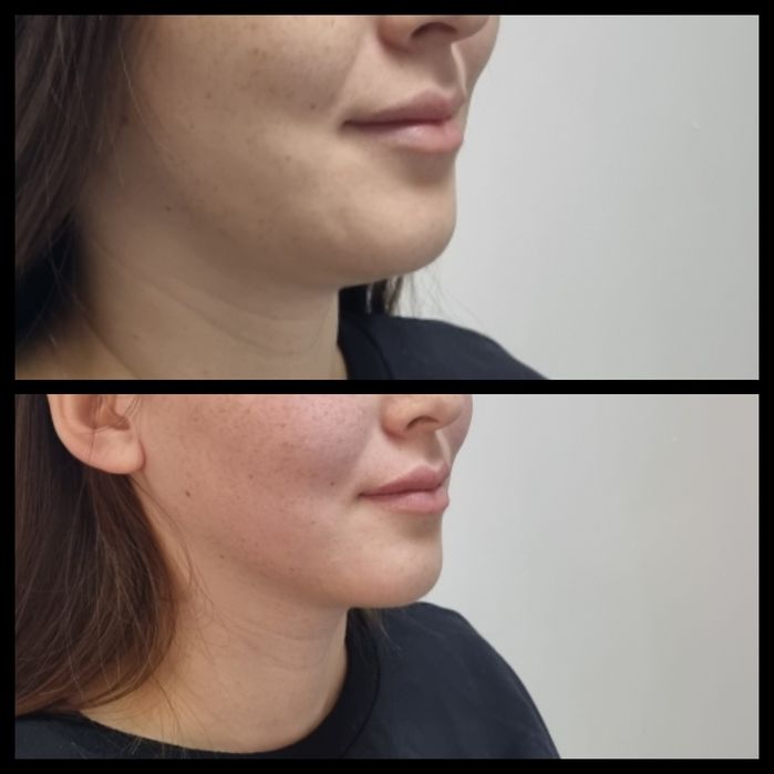 Массаж лица Караганда Юго-Восток