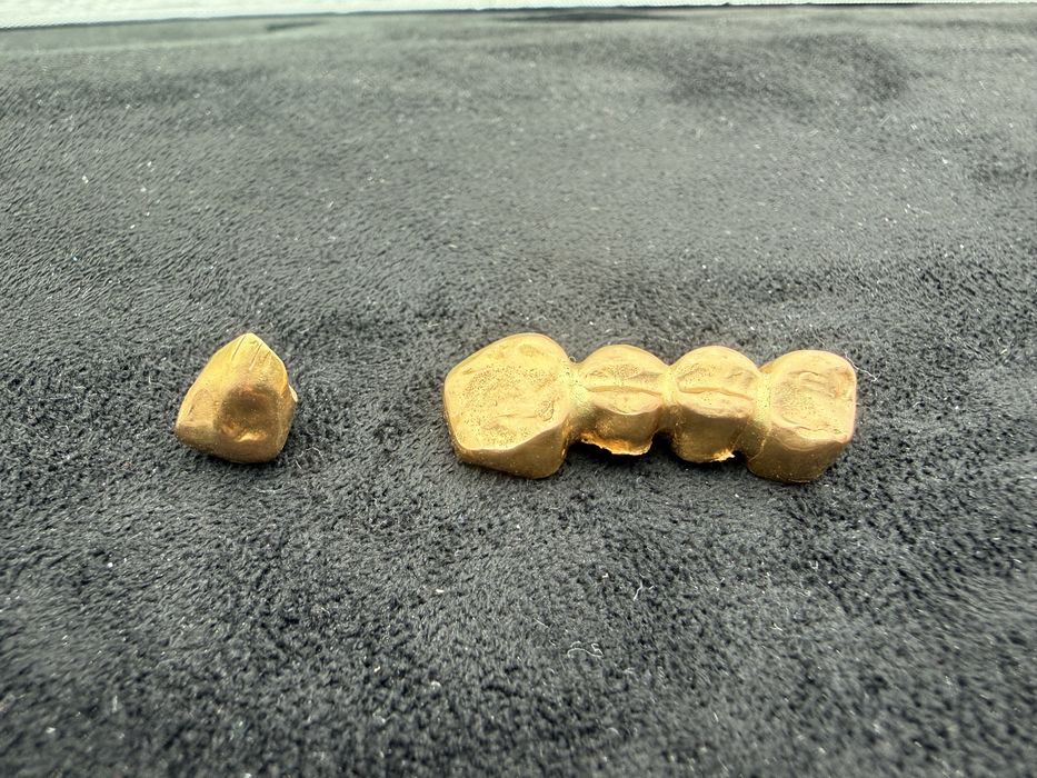 Золтые коронки 4.7 грамм 887 проба