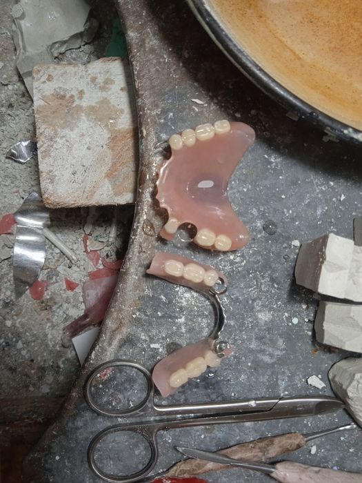 Продам протезы съёмные